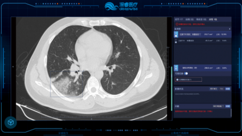2026年4月AI诊断助手胸片：从医学影像到病灶识别全链路深度拆解